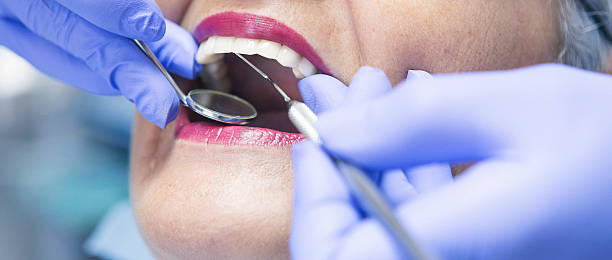 Best Chipped Tooth Repair Near Me  in Oakland, FL